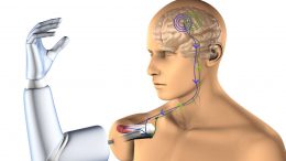 prothèse bluetooth